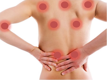 Nueva prueba de la existencia de la fibromialgia Nueva prueba de la existencia de la fibromialgia
