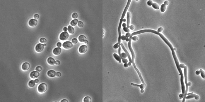 Candidiasis vaginal y digestiva: Nuevo tratamiento experimental Candidiasis vaginal y digestiva: Nuevo tratamiento experimental