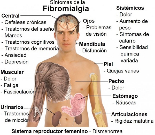 Síndrome de Sensibilidad Central: enfermedades de difícil diagnóstico Síndrome de Sensibilidad Central: enfermedades de difícil diagnóstico